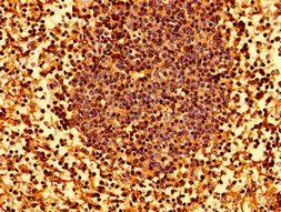 HLA-C Antibody