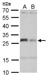 HLA-DMA Rabbit Polyclonal Antibody