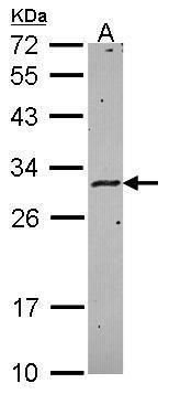 HLA-DMA Rabbit Polyclonal Antibody