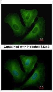 proteasome subunit alpha 6 Antibody