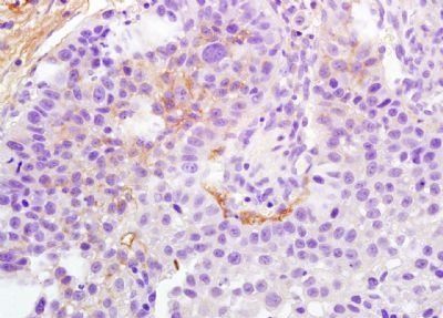 HLA DM Rabbit Polyclonal Antibody