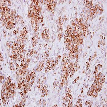 HLA-DMA Rabbit Polyclonal Antibody