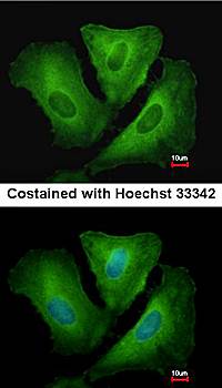 HLA-DRB3 Rabbit Polyclonal Antibody