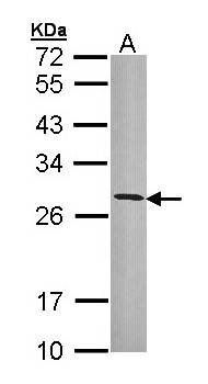 HLA-DRB3 Rabbit Polyclonal Antibody