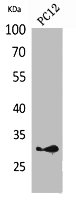 HLA-DQB1/HLA-DQB2 Antibody