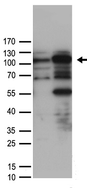 HLTF Antibody