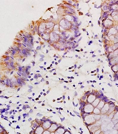 HMGA1 Rabbit Polyclonal Antibody