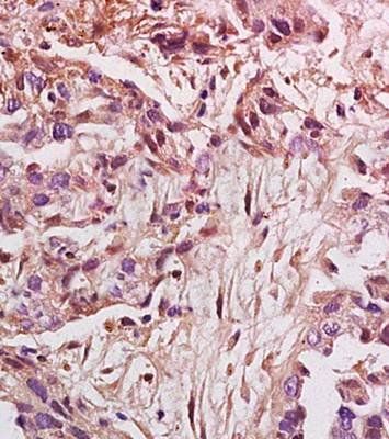 HMGA2 Rabbit Polyclonal Antibody