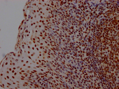 HMGB1 Antibody