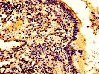 HMGB3 Antibody