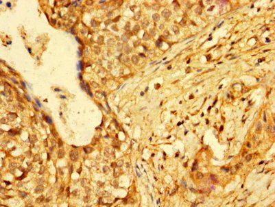 HMGB3 Antibody