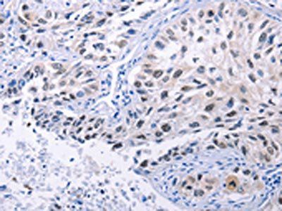 HMGB3 Antibody