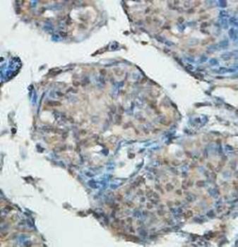HMGB4 Rabbit Polyclonal Antibody