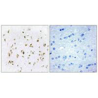 HMGN2 Antibody