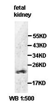 HN1L Rabbit Polyclonal Antibody