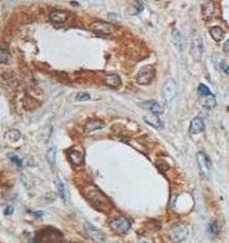 HN1L Rabbit Polyclonal Antibody