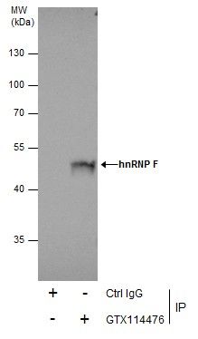 heterogeneous nuclear ribonucleoprotein F Antibody
