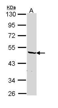 heterogeneous nuclear ribonucleoprotein F Antibody