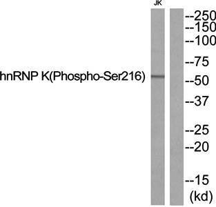 hnRNP K (Phospho-Ser216) Antibody