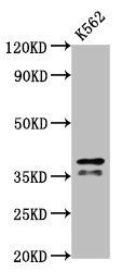 HNRNPAB Antibody