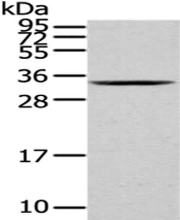 HNRNPC Antibody