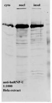 hnRNP F+H Monoclonal Antibody