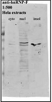 hnRNP F Monoclonal Antibody