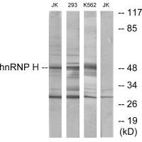 HNRNPH2 Antibody