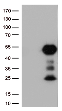 HNRPH1 Antibody