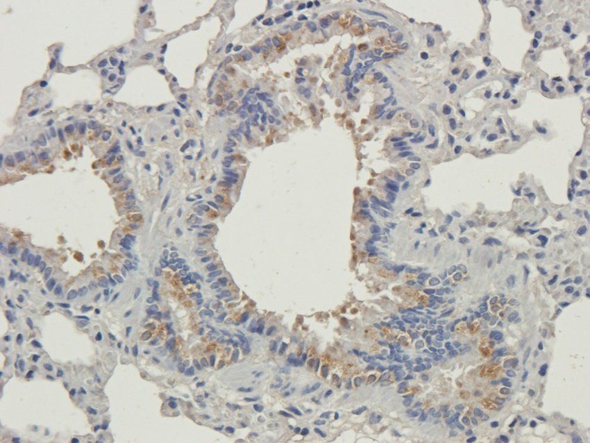 HOMER1 Rabbit Polyclonal Antibody