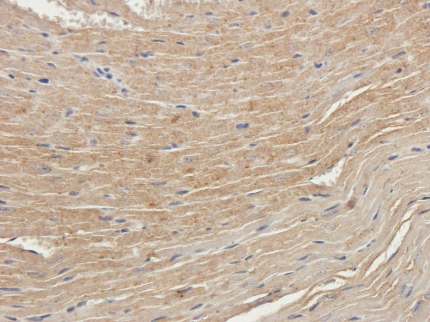 HOMER1 Rabbit Polyclonal Antibody