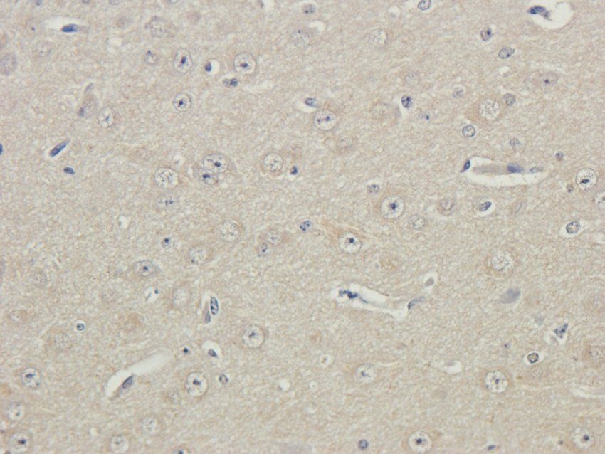 HOMER1 Rabbit Polyclonal Antibody