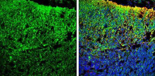 homer scaffold protein 1 Antibody