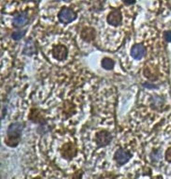 HOMER2 Rabbit Polyclonal Antibody