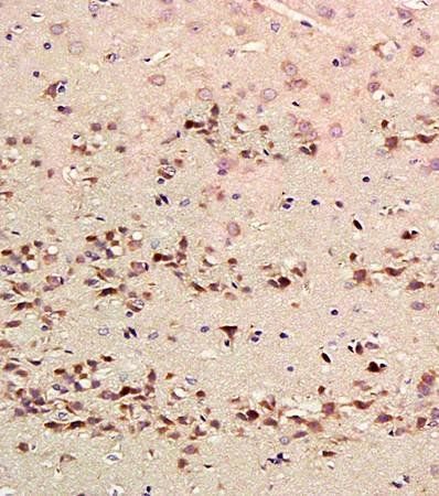 HOMER3 Rabbit Polyclonal Antibody