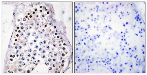 HOXA1/B1/D1 Antibody