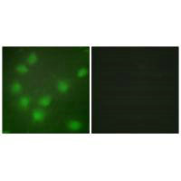 HOXA11/HOXD11 Antibody