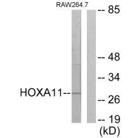 HOXA11/HOXD11 Antibody