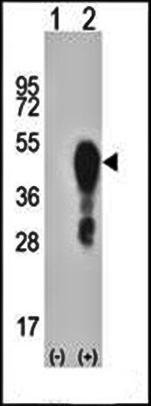 HOXA1 Antibody