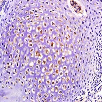 HOXA9 Rabbit Polyclonal Antibody