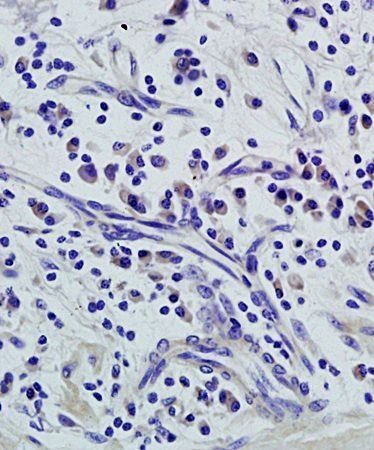 HOXB2 Rabbit Polyclonal Antibody