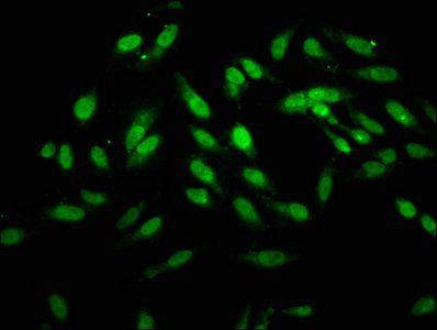 HOXB4 Antibody
