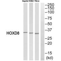 HOXD8 Antibody