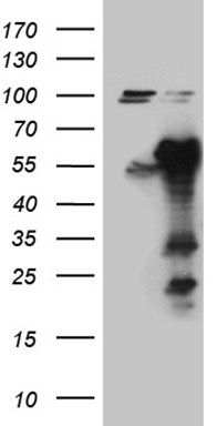 HOXD9 Antibody
