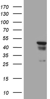 HOXD9 Antibody