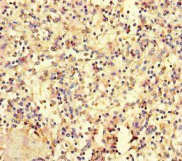 HOXD9 Antibody