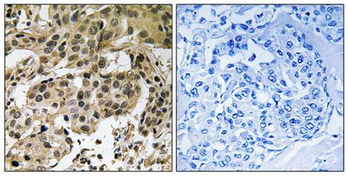 HP1α (Phospho-Ser92) Antibody