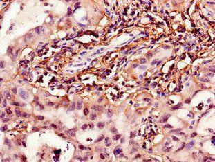HPGD Antibody