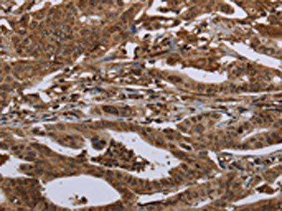 HPGD Antibody