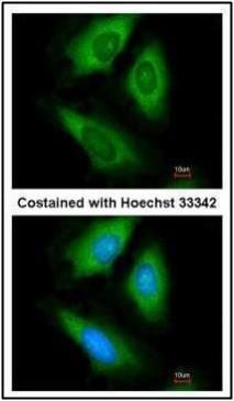 hypoxanthine phosphoribosyltransferase 1 Antibody